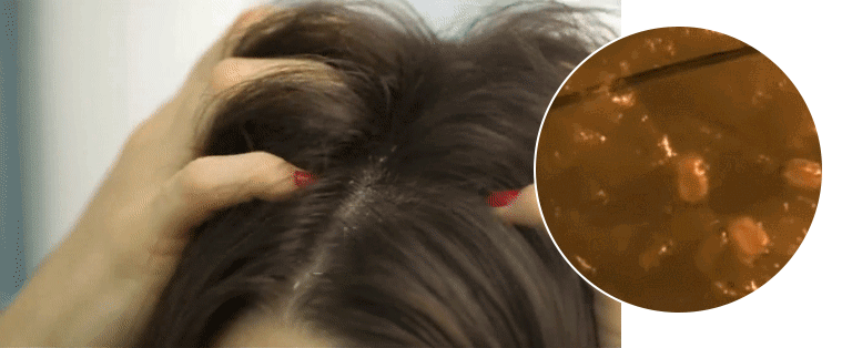 开云电竞:烦为什么女生要洗头?(图3)