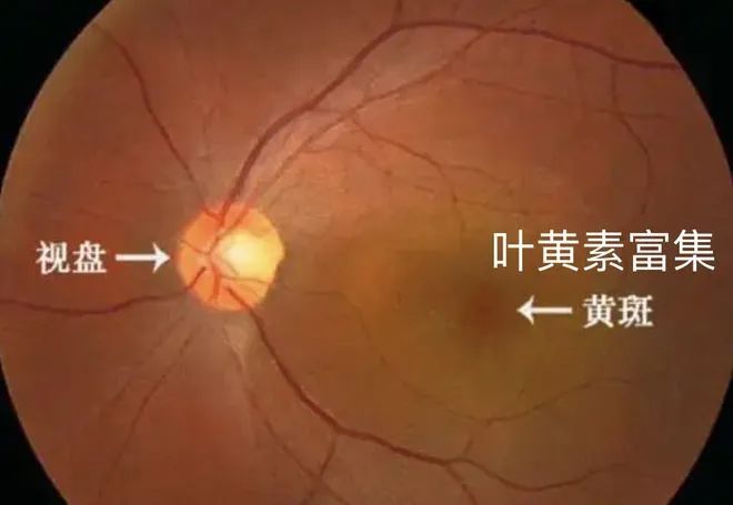 一天18个小时离不开电子屏幕谁来救救我的眼睛？(图3)