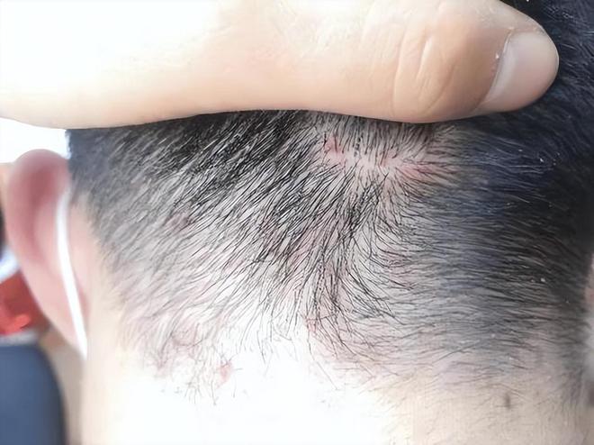 开云电竞:震惊！“毒洗发水”已曝光长期使用会变秃还有很多家庭都在用(图9)