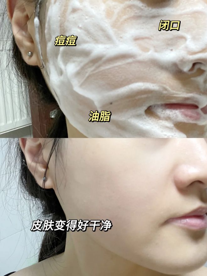 洗面奶品牌排行榜前十名最好用排行第一的产品是咱们国货品牌(图4)